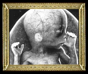 The Fetal Sect